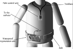 Wearable Artificial Kidney Future