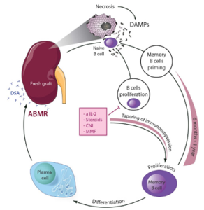 What is Renal Transplant Rejection?