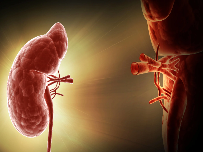 Understanding Kidney Transplantation