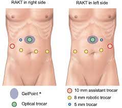 Post-Transplant Responsibilities