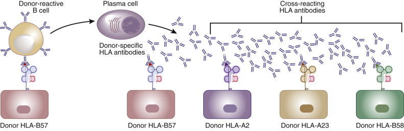The Major HLA Genes in Kidney Transplantation